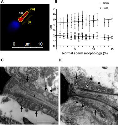 Mitochondrial metabolism determines the functional status of human sperm and correlates with semen parameters